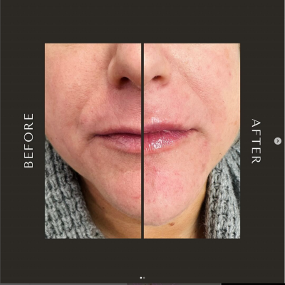 Screenshot 2024-10-31 at 09-24-21 Alpine Glow Medspa (@alpine_glow_medspa) • Instagram photos and videos